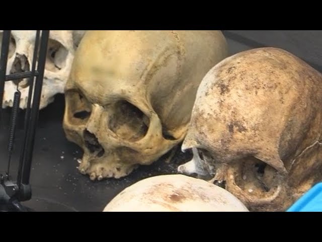 Medicina Forense: ¿Cuántos años de carrera?