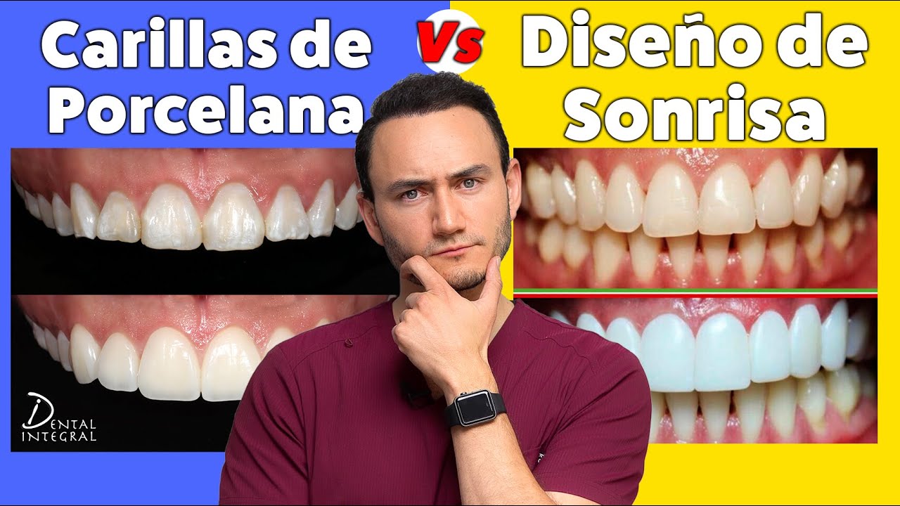 Costo de diseño de sonrisa en México
