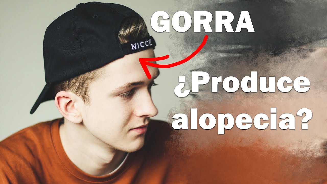 Gorra: la parte superior de la cabeza