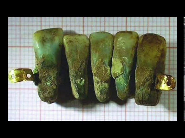 Historia de materiales dentales: línea temporal